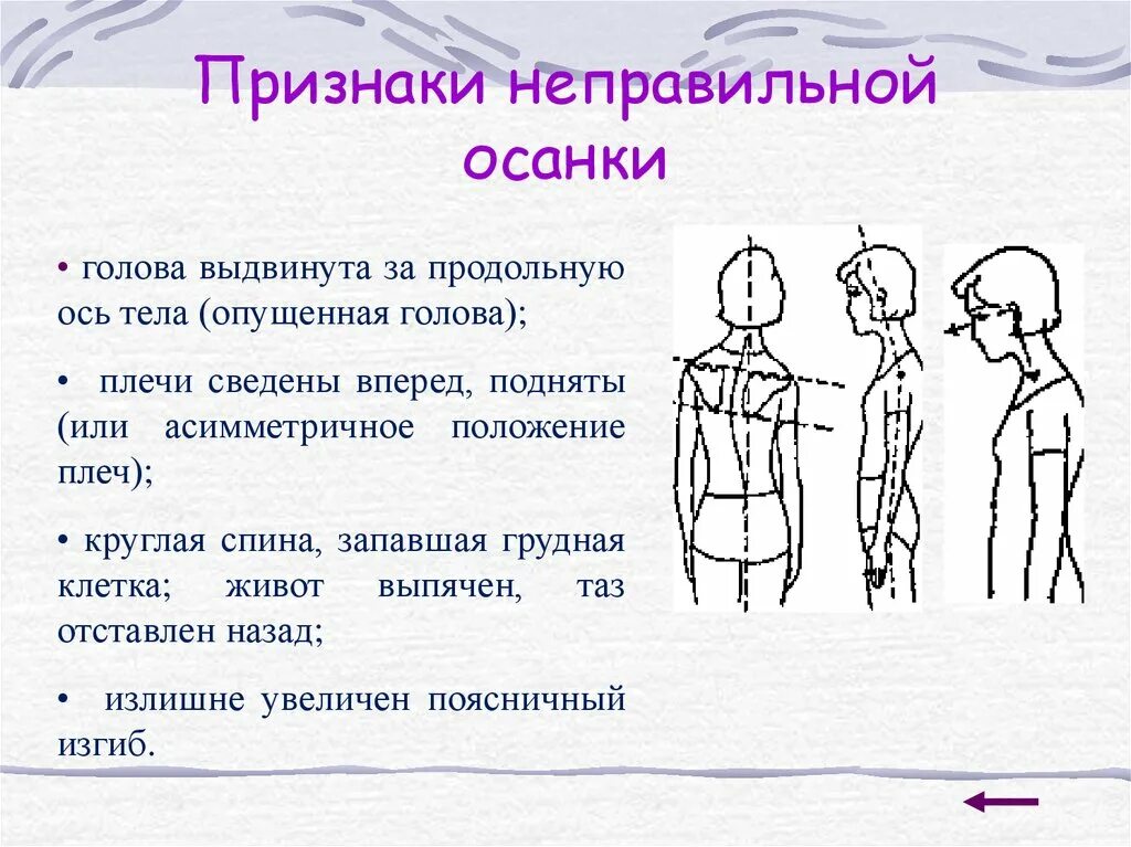 Признаки не правильннойосанки. Презентация на тему осанка. Осанка человека презентация. Правильная осанка. Иметь голову на плечах 2 предложения