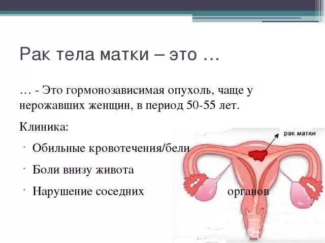 Клиника рака матки. Карцинома женских органов.