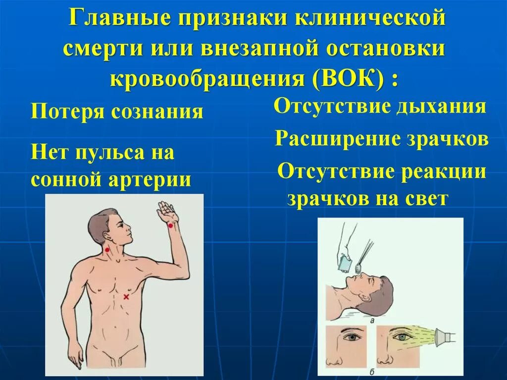 Признаки клинической смерти. Признаки клинической. Марти. Признаки клиническойсмерьти. Определение признаков клинической смерти. Характерные признаки клинической смерти