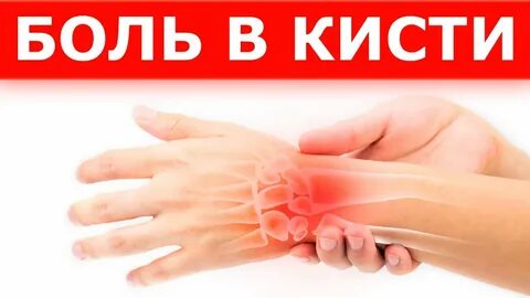 Болит кисть правой руки чем лечить