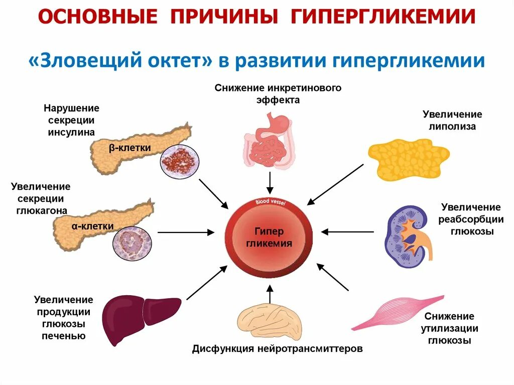 Синдром хронической гипергликемии. Клинические проявления сахарного диабета гипергликемия. Причины гипергликемии при сахарном диабете. Хроническая гипергликемия сахарный диабет.