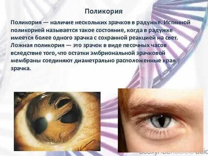 О чем говорят расширенные зрачки