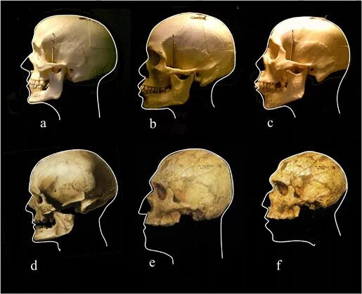Эволюция черепа человека. Ортогнатные брахицефалы. Строение черепа у монголоидной расы. Типы форм черепа. Череп человека анатомия в форме трилистника.