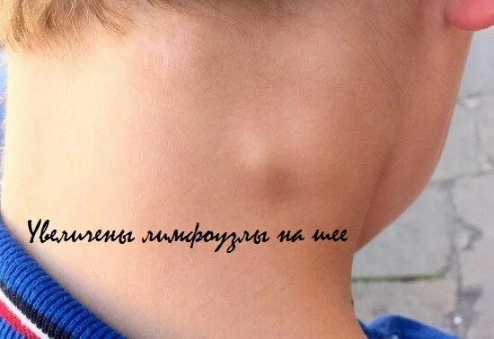 ВОПРОСЫ ПЕДИАТРУ. ЧИТАЕМ ПЕРВЫЙ ПОСТ! Мамочки города Октябрьского ВКонтакте
