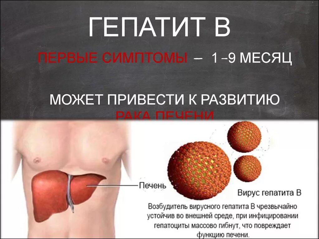 Гепатит б переболел