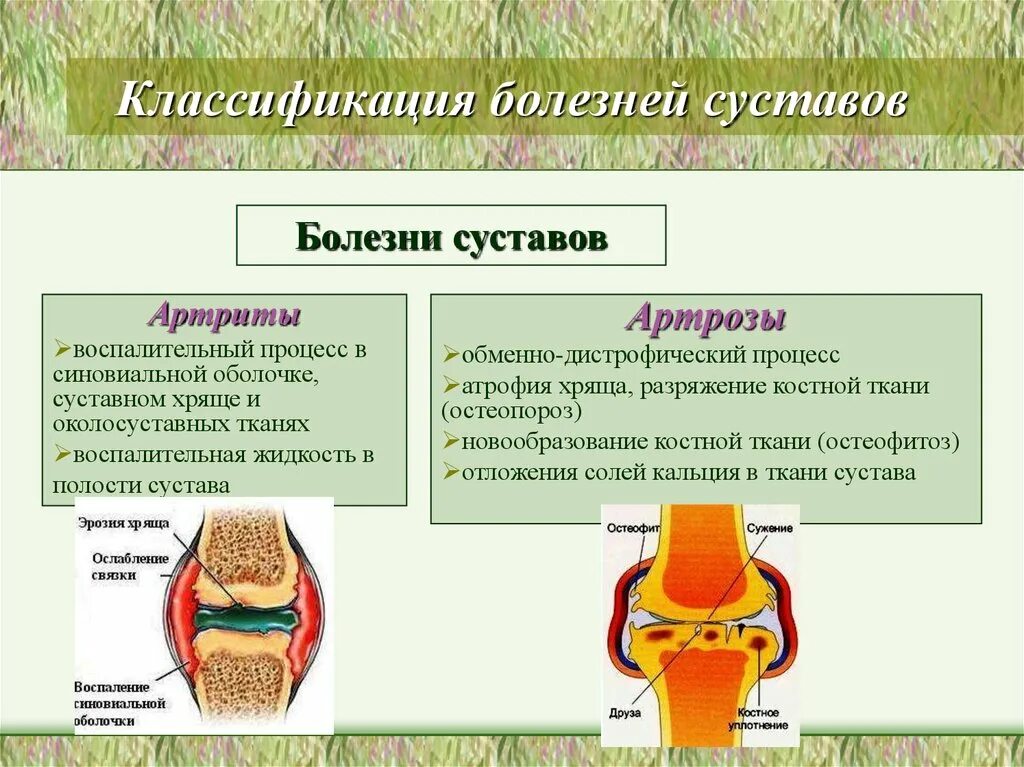 Причины заболевания суставов лечение. Классификация поражения суставов. Классификация патологии суставов. Суставы классификация суставов. Суставные заболевания классификация.