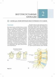 Блокада спины отзывы