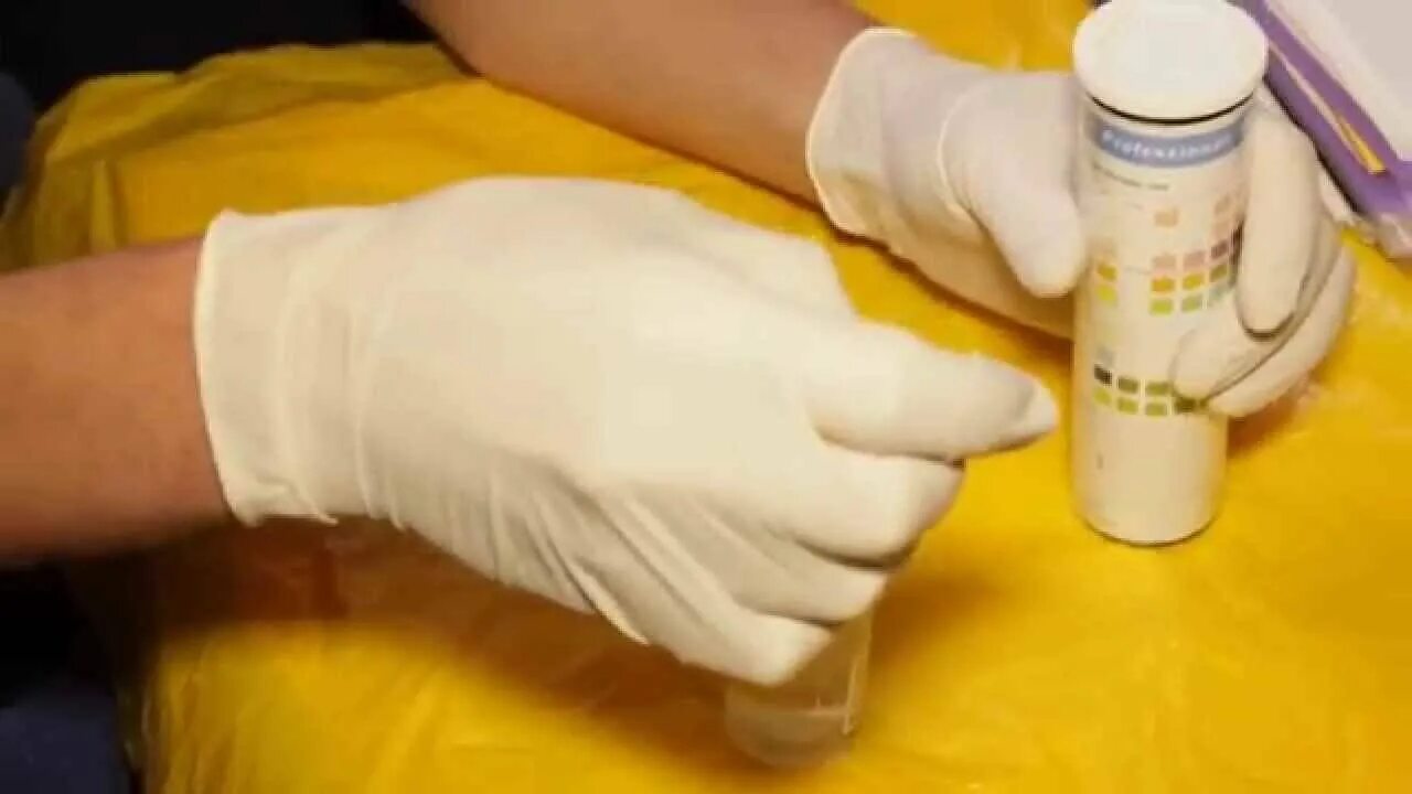 Моча крс. Кетоз крс профилактика. Моча крс. Моча крс. Анализ мочи крс норма.