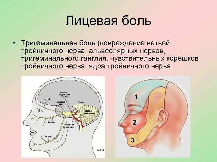 Лицевые боли. Головные и лицевые боли неврология. Лицевой и тройничный нервы. Лицевые боли классификация.