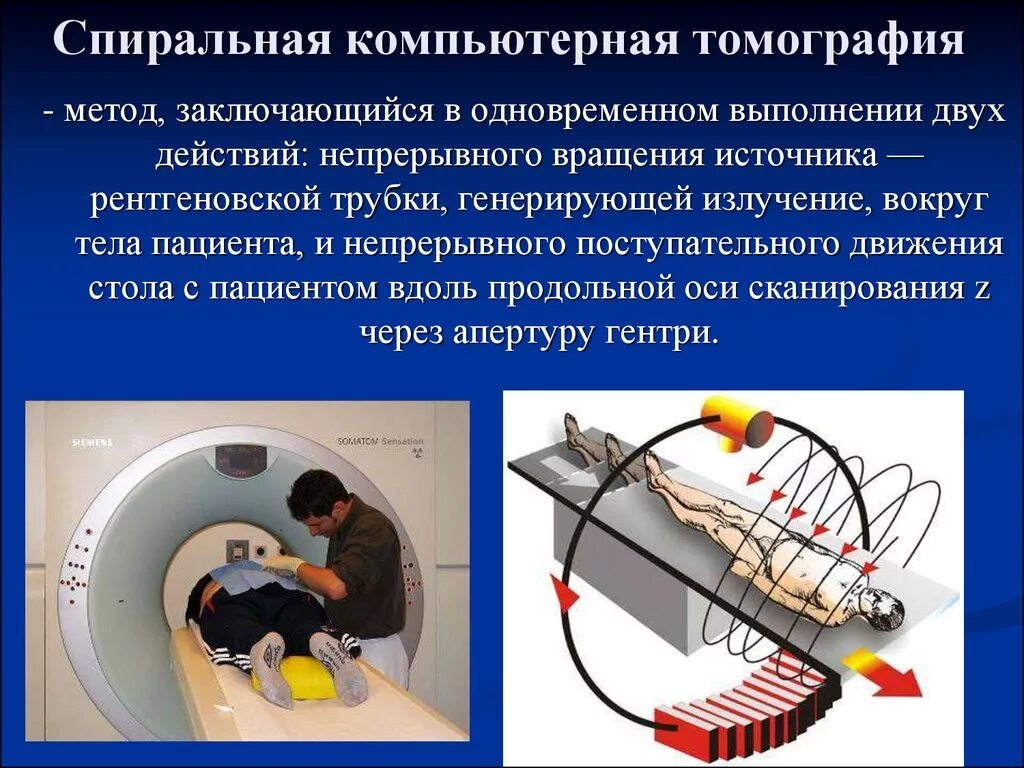 Перед кт что нужно. Рентгеновская компьютерная томография принцип метода. Спиральное сканирование кт. Спиральная рентгеновская компьютерная томография. Спиральная и Мультиспиральная компьютерная томография.