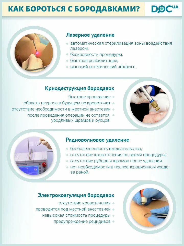 Удаление бородавок лазером ребенку. Профилактика бородавок. меры профилактики бородавок. после лазерного удаления бородавки.