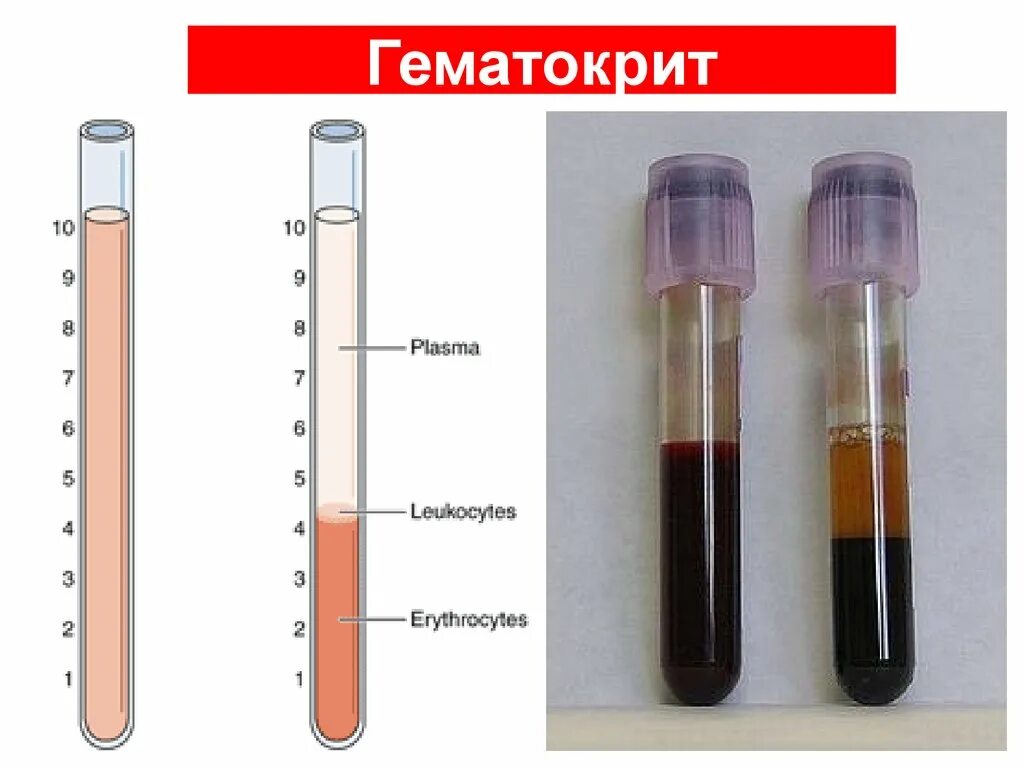 Гематокрит 0.55. Гематокрит при анемии показатели. Схема гематокрита. Гематокрит пробирка.