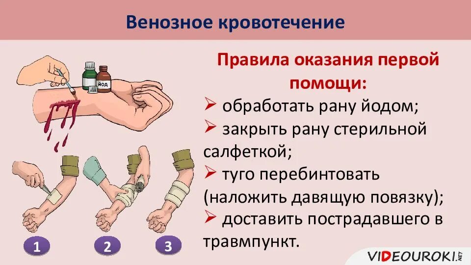 1 помощь при открытом кровотечении. Алгоритм оказания первой помощи при венозном кровотечении. алгоритм оказания первой помощи при наружном венозном кровотечении.. пмп при венозном кровотечении. оказание первой помощи пострадавшему при венозном кровотечении..