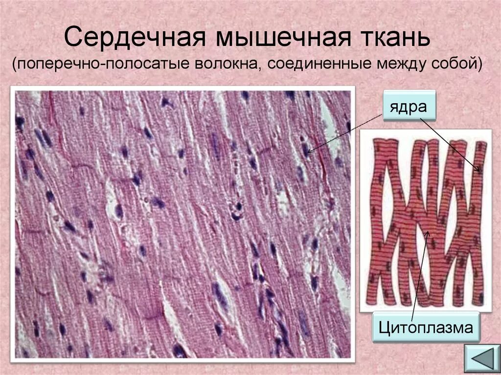 Волокна поперечно полосатой мышечной ткани ядра. Поперечно-полосатая сердечная мышечная ткань. Поперечнополосатая мышечная ткань гистология. Поперечнополосатая сердечная мышечная ткань гистология препарат. Поперечнополосатая сердечная мышечная ткань рисунок.