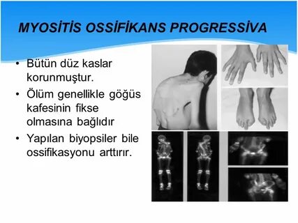 Myositis латынь