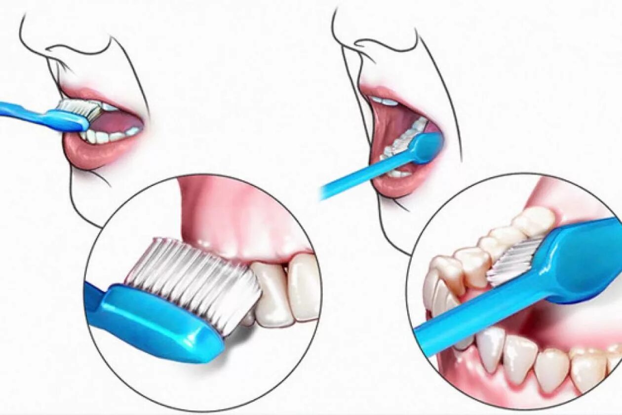 Проф гигиена ротовой полости. Гигиеническая обработка полости рта. Метод чистки зубов электрической щетки. Алгоритм чистки зубов. Как чистить десна
