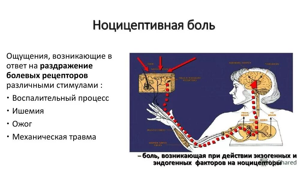 Ощущение возникают при рецепторов. Патофизиология боли. Ноцицептивная системы. Ноцицептивная боль возникает при. Механизм формирования ноцицептивной боли. Ноцицепторы это физиология.