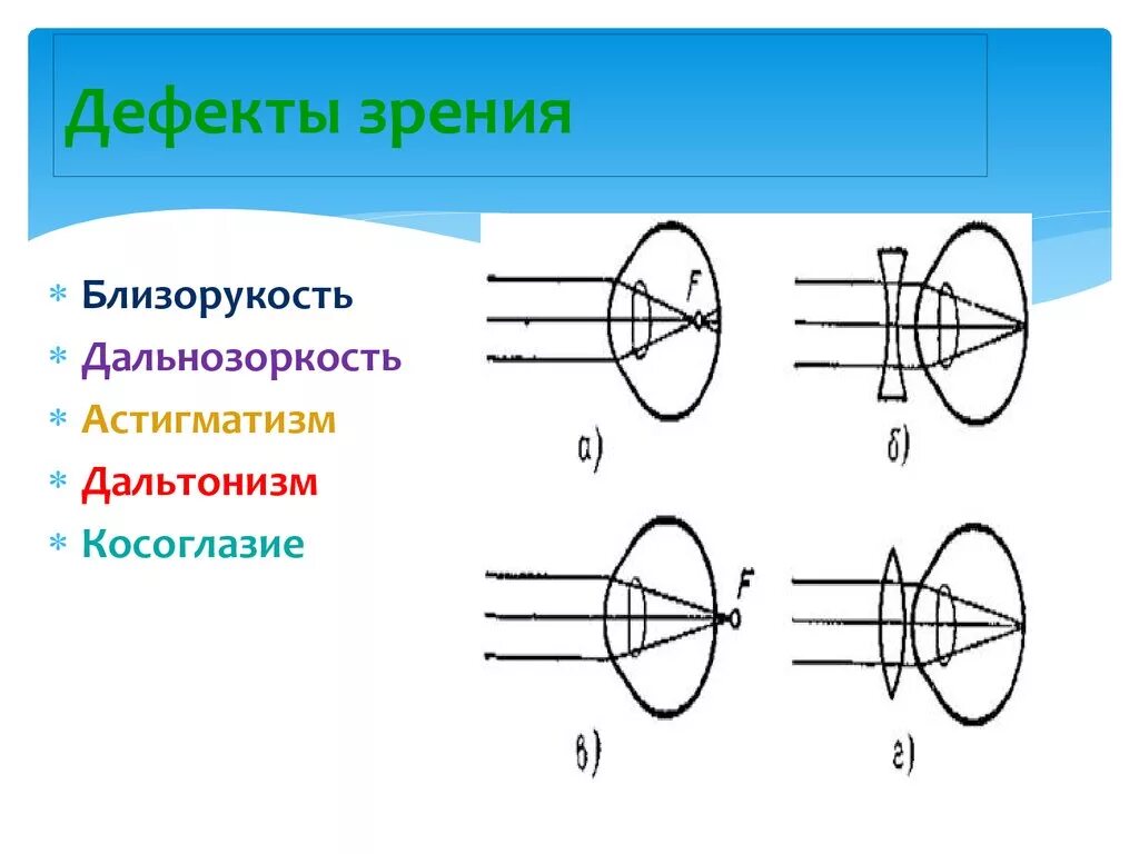 Глаз и зрение физика 9. Дефекты зрения дальнозоркость физика. Дефекты зрения близорукость. Дефекты зрения дальнозоркость и близорукость и их коррекция. Дефекты зрения схемы.