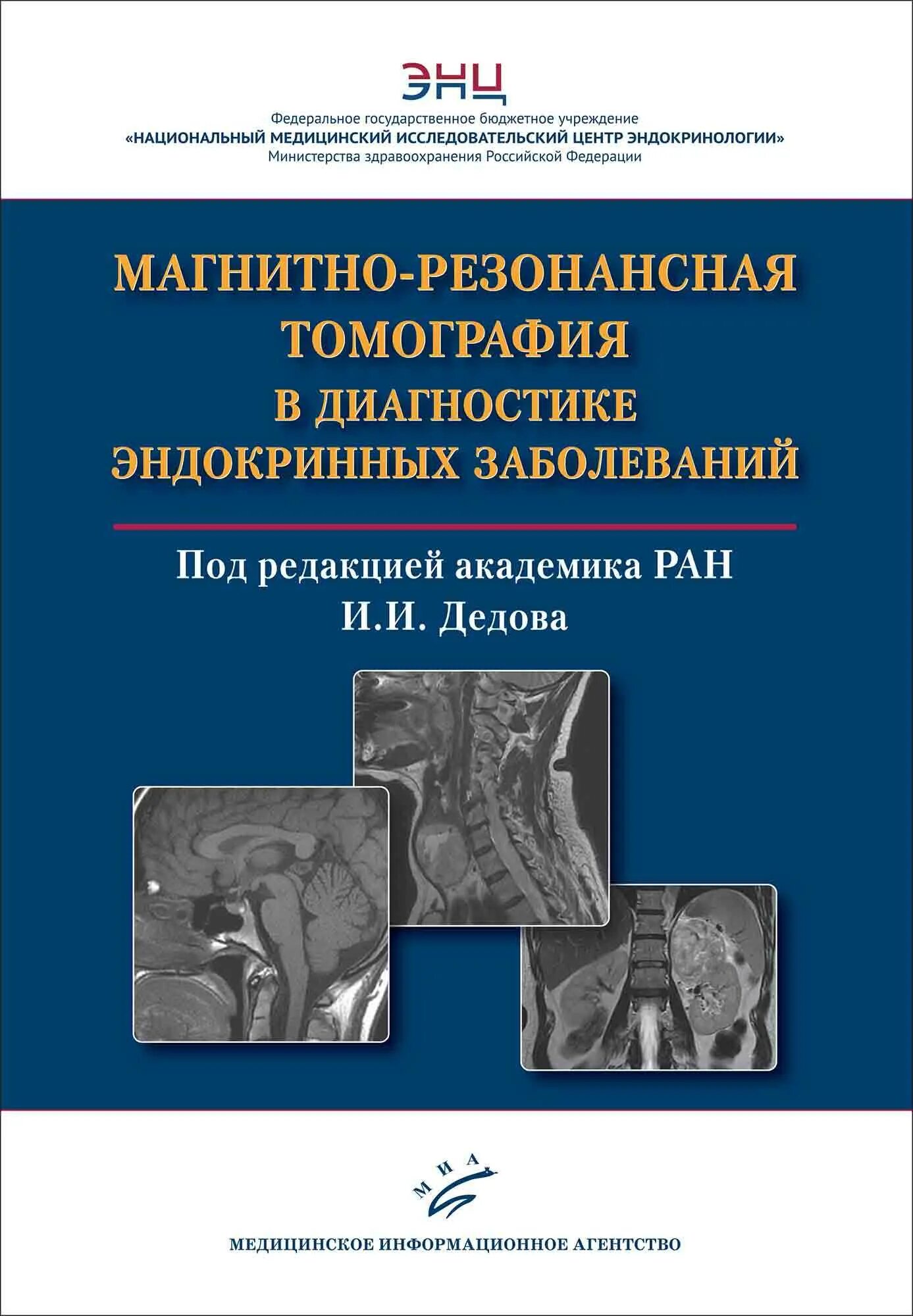 Диагностика в эндокринологии. Магнитно-резонансная томография. Лучевая диагностика в эндокринологии. Диагностика эндокринных заболеваний. Магнитно-резонансная томография в эндокринологии.