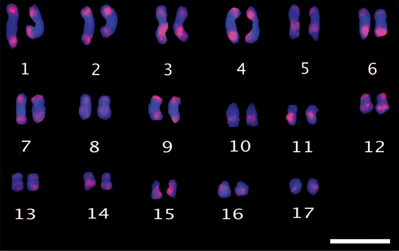 Karyotype. Кариотип человека микроскоп. Кариограмма хромосом. Цитогенетика. Поворот хромосом на 180 градусов