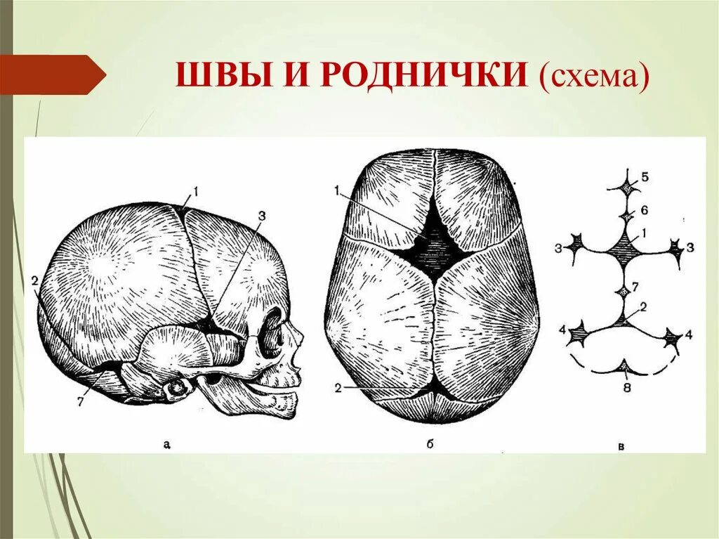 Роднички вакансии. Большой и малый родничок. Череп младенца темечко. Роднички вакансии. Теменная кость на черепе у ребёнка.