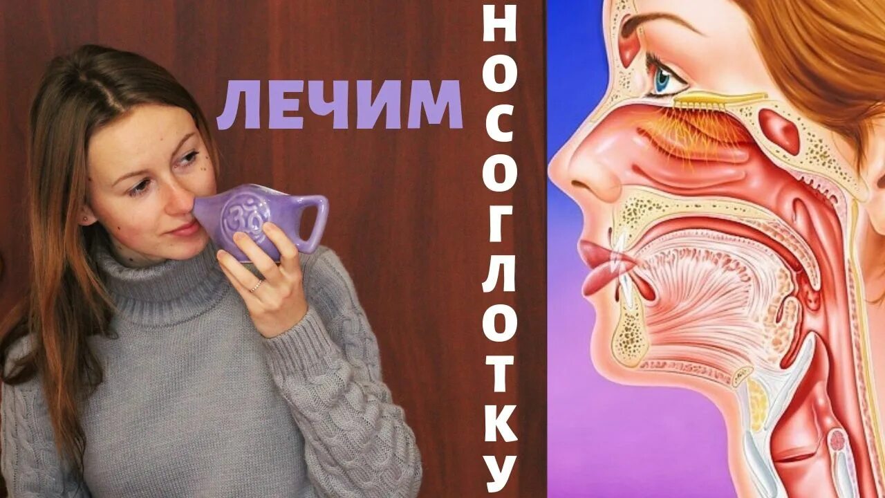 Долгая заложенность носа. Гайморит тонзиллит ринит. Заложенность носа без насморка. Вылечить синусит навсегда.