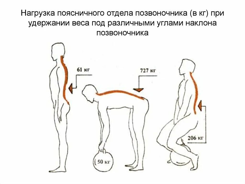 Нагрузка на поясницу. Статические и осевые нагрузки на позвоночник. Нагрузка на позвоночник. Осевая нагрузка на спину. Ударная нагрузка на позвоночник.