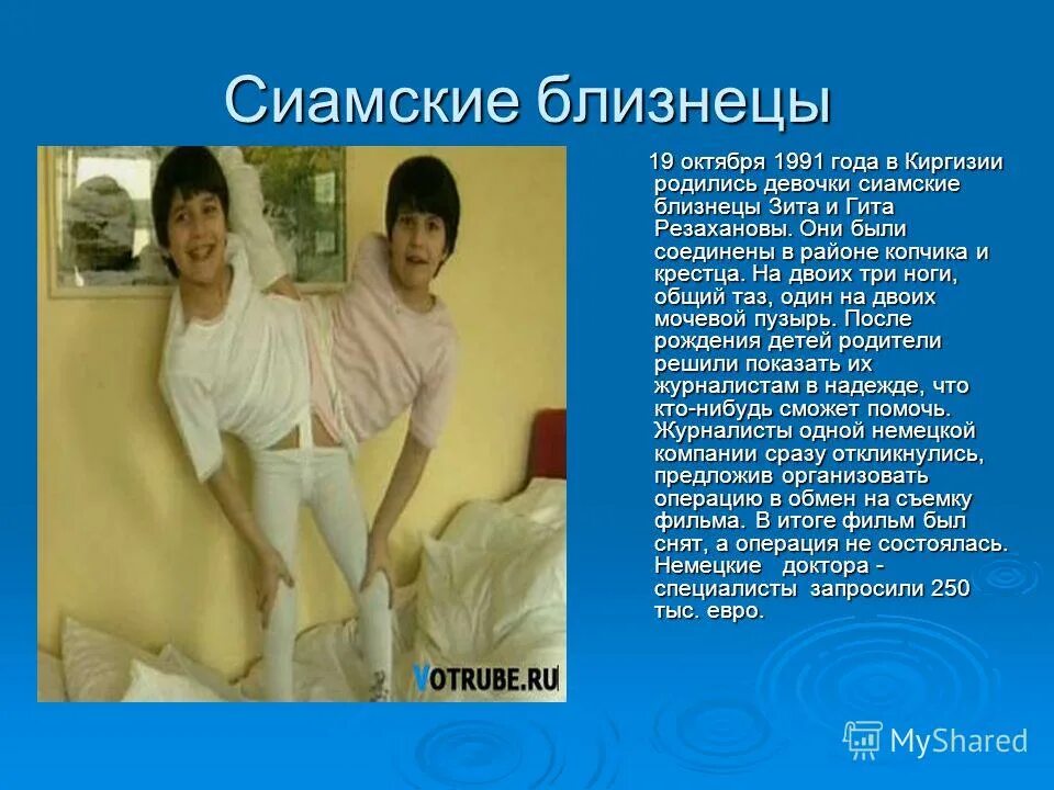 Зита и гита резахановы. Сиамских близнецов зиты и гиты. Сёстры резахановы зита. Зита рашидовна резаханова. Сёстры резахановы зита.