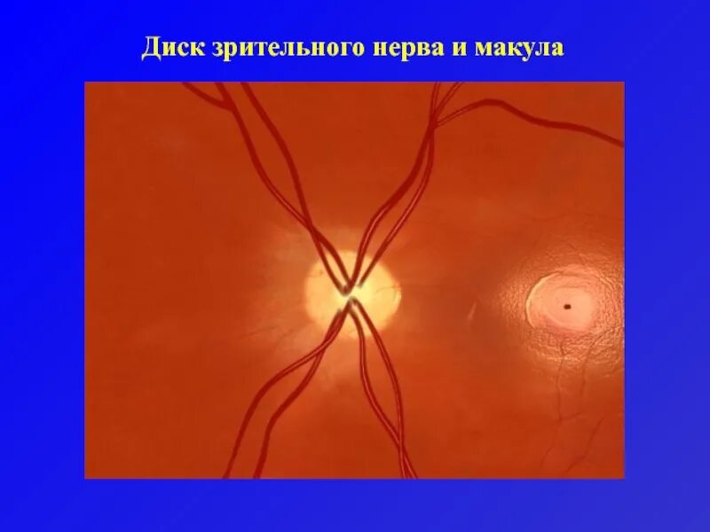 Тип зрительного нерва. Макула и диск зрительного нерва. Миелиновые волокна ДЗН. Диск зрительного нерва анатомия. Макула от диска зрительного нерва.