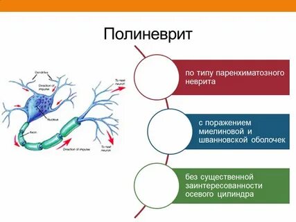 Полиневрит это