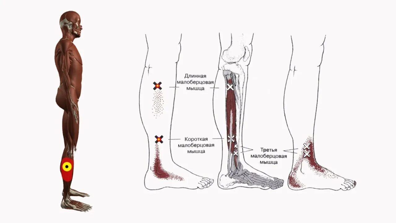 Почему болит низ ноги. Триггерные точки большеберцовой мышцы голени. Триггерные точки голеностопного сустава. Триггерные точки передней большеберцовой мышцы. Триггерные точки мышц стопы и голени.