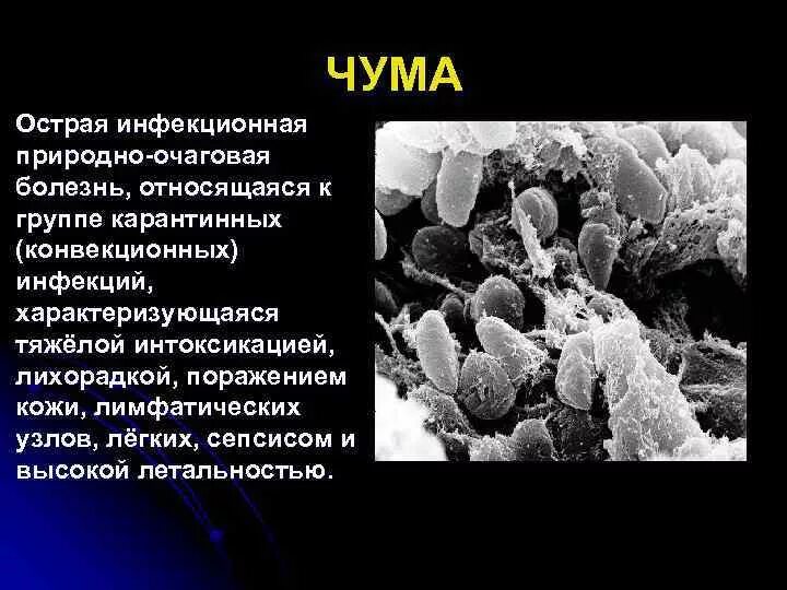 Чума острое природно-очаговое инфекционное заболевание. Чума относится к группе инфекций. Формы заболевания чумы. Группа заболеваний чумы. Чума какая болезнь