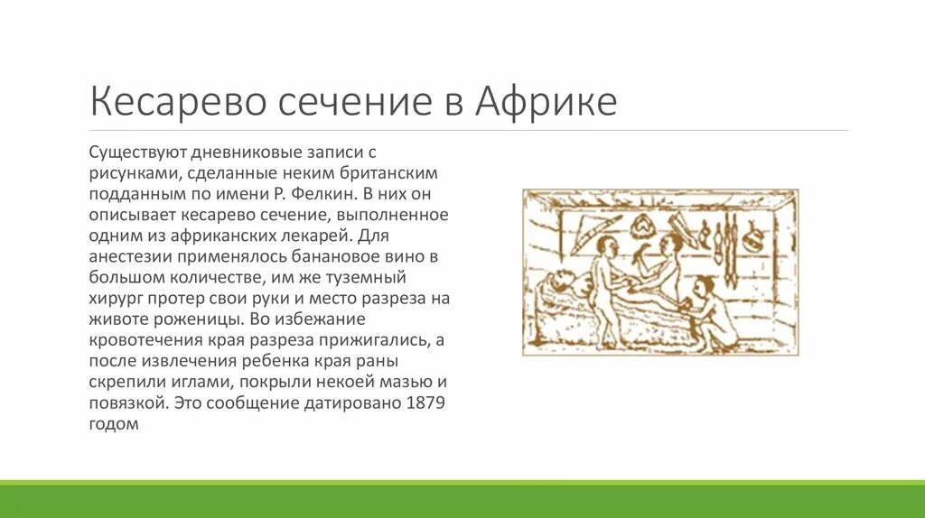 Божья божьего кесарево кесарево. Кесарево сечение в древности. История кесарева сечения. История операции кесарево сечение. Кнсаревосечение история.