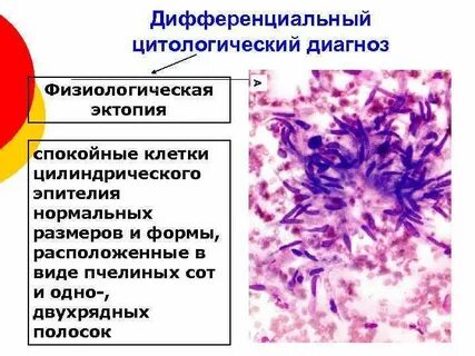 Цитологический диагноз