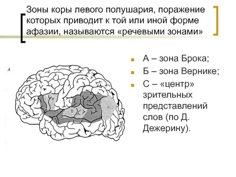 Очаги в коре головного мозга. Речевые центры. Зона Брока. Зона Вернике. Речевые зоны коры головного мозга Брока. Схема головного мозга зона Вернике зона Брока.