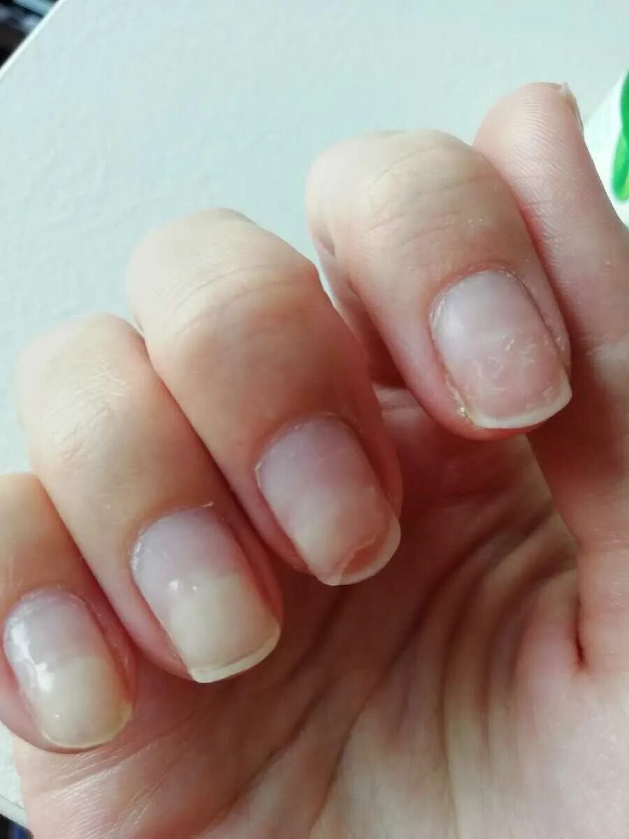 Ногти после снятия гель лака. Спиленные ногти после шеллака. Белые ногти после снятия лака. Ногти после снятия гель лака. Ногти после гель лака испортились.