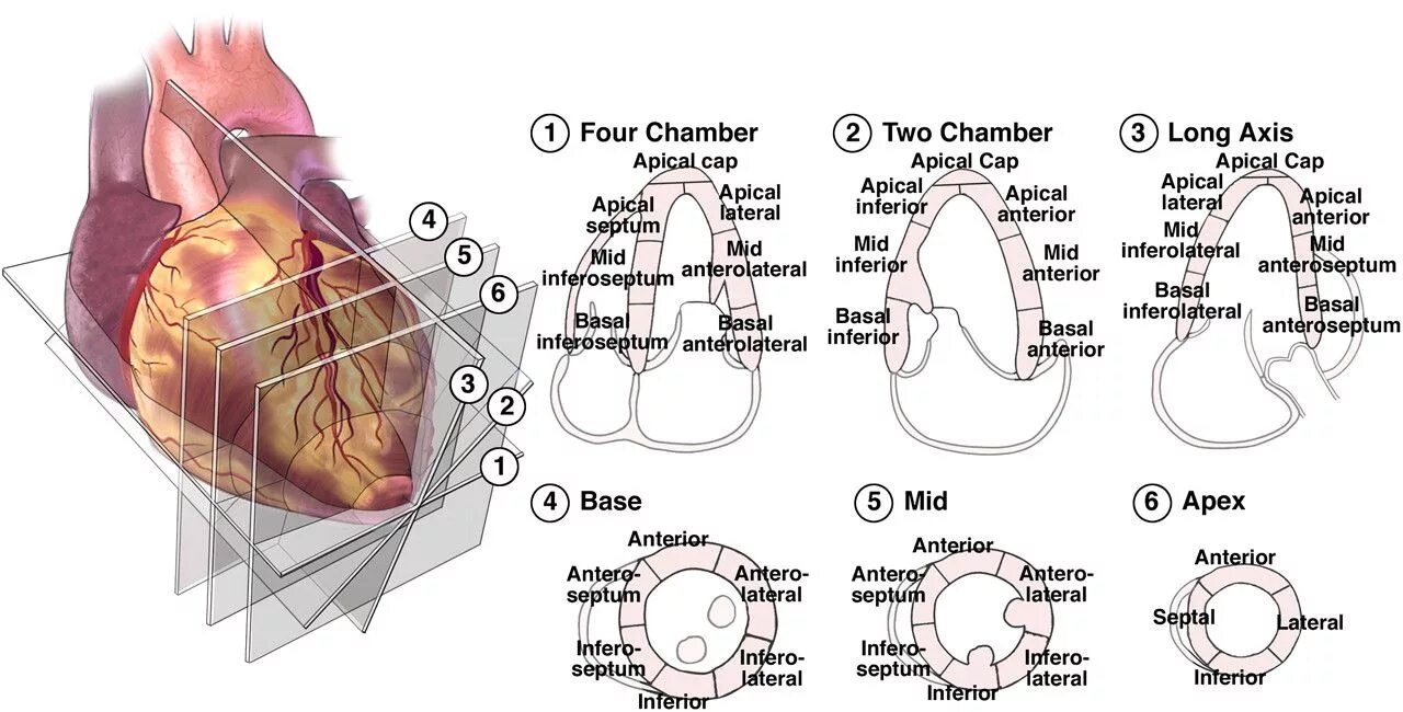 Локальная сократимость левого желудочка. Сегменты миокарда при ЭХОКГ. Сегментарное строение миокарда ЭХОКГ. Сегменты левого желудочка ЭХОКГ схема. Сегменты миокарда левого желудочка схема.