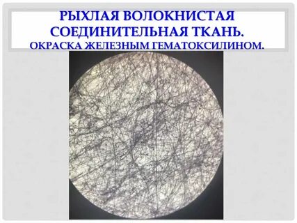 Железный гематоксилин