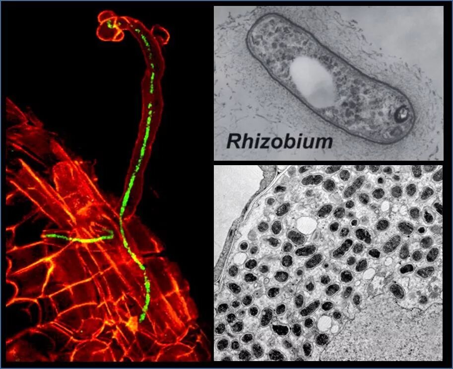 клубеньковые бактерии ризобиум. бактерии rhizobium. клубеньковые бактерии ризобиум. азотфиксирующие клубеньки. бактерии rhizobium.