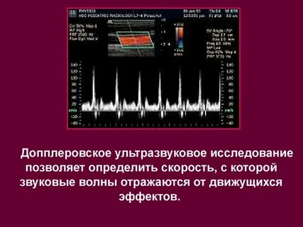 Спектр узи