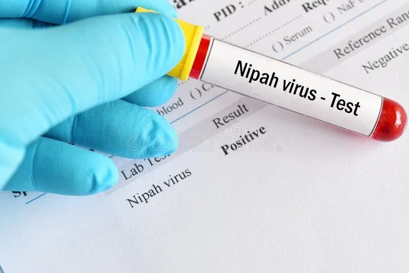 Virus testing. Вирус Нипах на человеке симптомы.