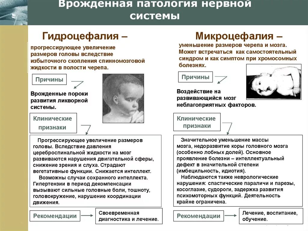 Микроцефалия причины. Врожденные заболевания с поражением нервной системы. Врожденные заболевания и пороки развития нервной системы.. Врождённые заболевания нервной сиситемы. Врожденные заболевания нервной системы у детей.