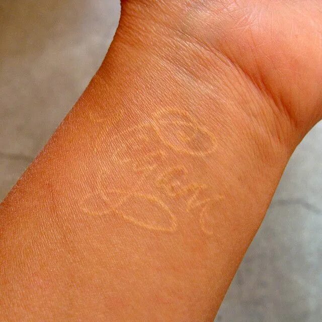 Как выглядит белое тату White Ink Tattoo White ink tattoos healed, White tattoo, Healing tattoo