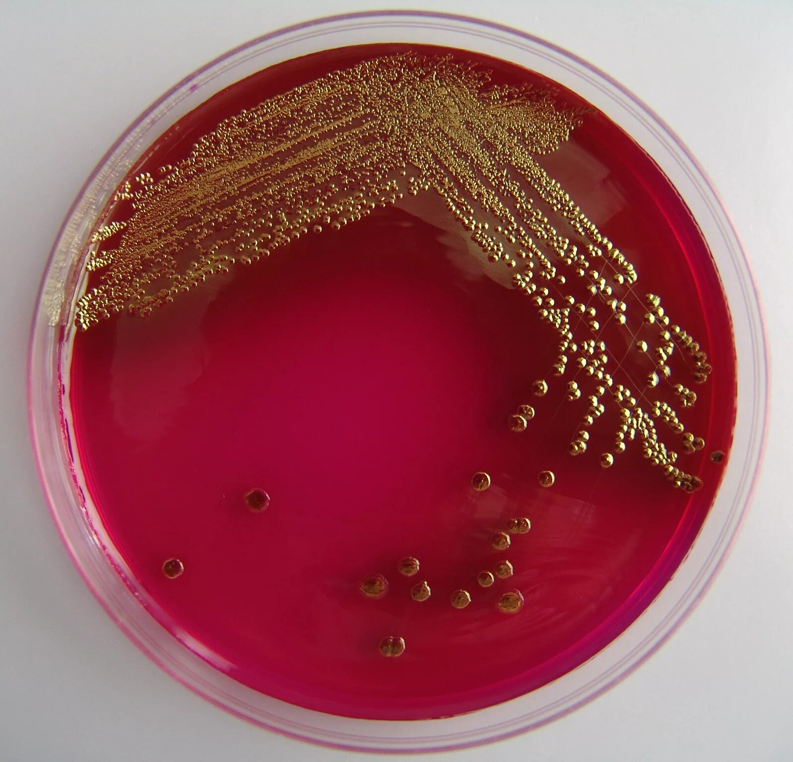 Свойства кишечной палочки. Эшерихии на Эндо. Кишечная палочка Escherichia coli. Среда Эндо микробиология. Эшерихия кишечная палочка.