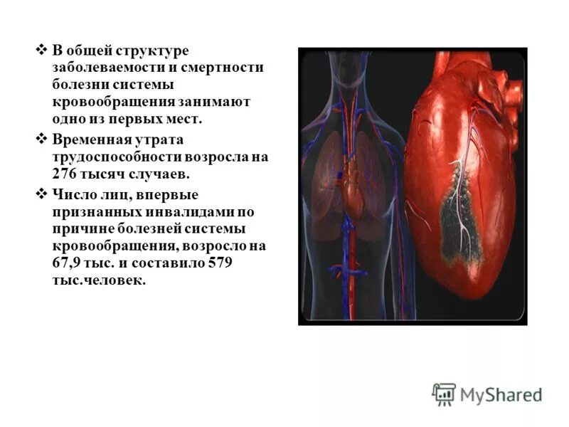 Воздействие на кровообращение. Болезни системы кровообращения. Пикс это в кардиологии. Меры воздействия на кровообращение. Летальность от болезней системы кровообращения формула.