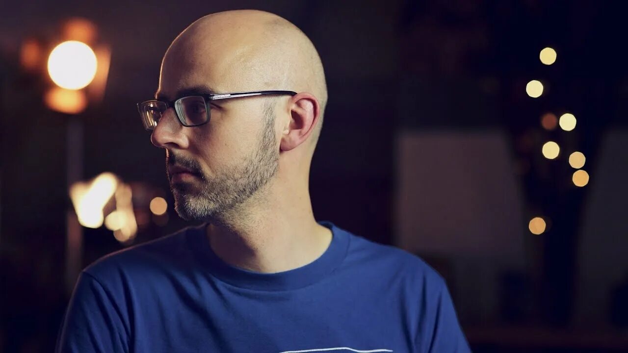 Alex burnt. Alex burnt. Alex burn. Alex burnt. Hedz.