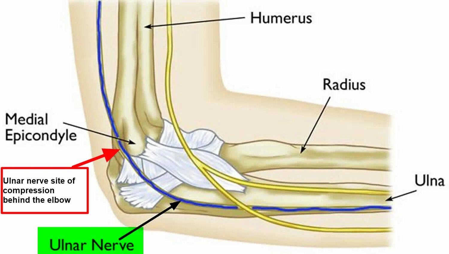 Невропатия локтевого нерва мкб. Локтевой нерв мкб 10. Ulnar Groove.. Ulnar nerve. Кубитальный канал ютуб.