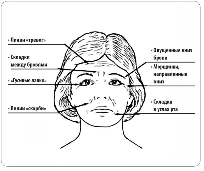 Как называется между бровями. Морщины на лице названия. супраментальная складка. вертикальная морщина между бровей. морщины на лице о чем говорят.