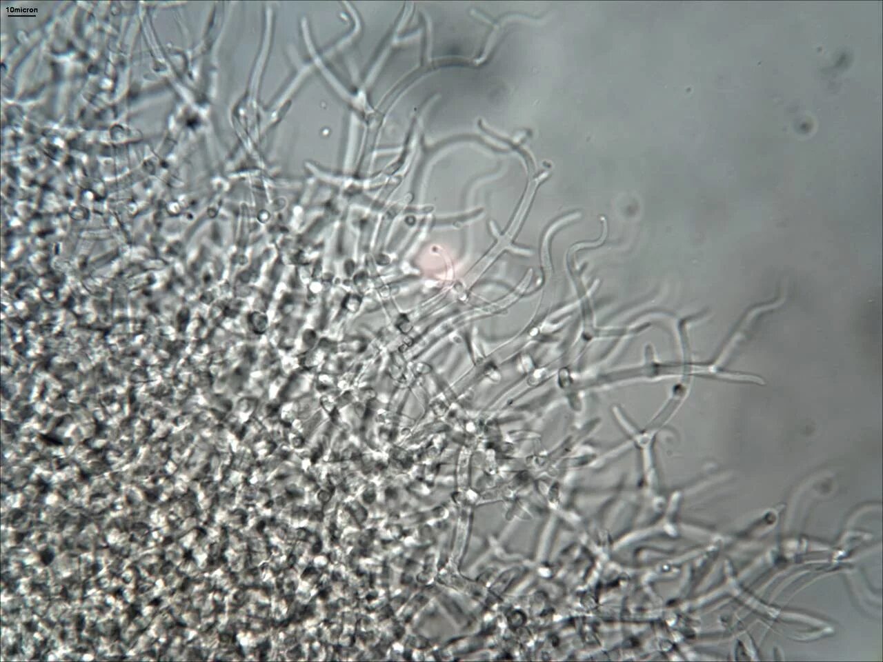 Грибы под микроскопом. Микроскопия trichoderma. trichoderma koningii. мицелий триходермы под микроскопом. споры триходермы.