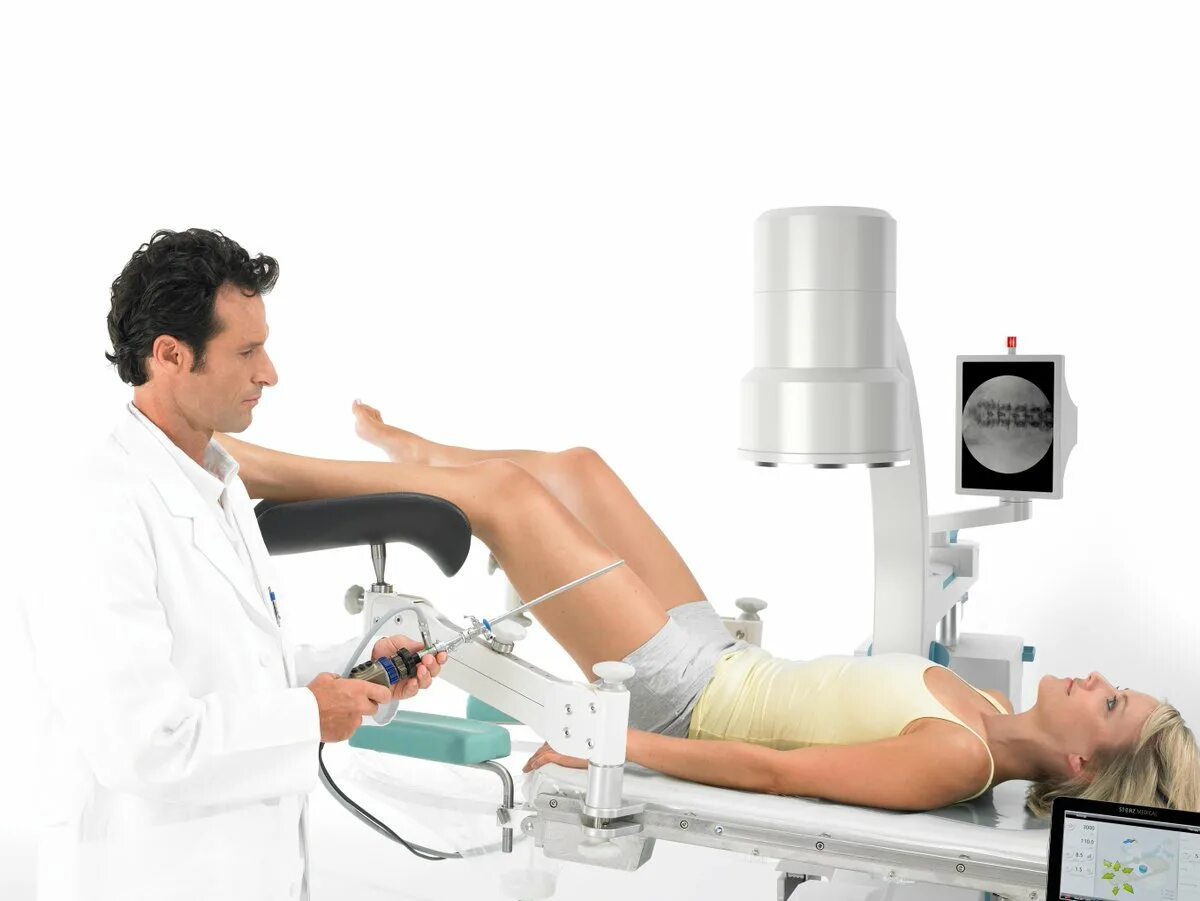 Ультразвуковое дробление камней. Литотрипсия что это. Экстракорпоральная ударно-волновая холелитотрипсия. Контактная литотрипсия камней мочеточника. Modulith slx-f2.